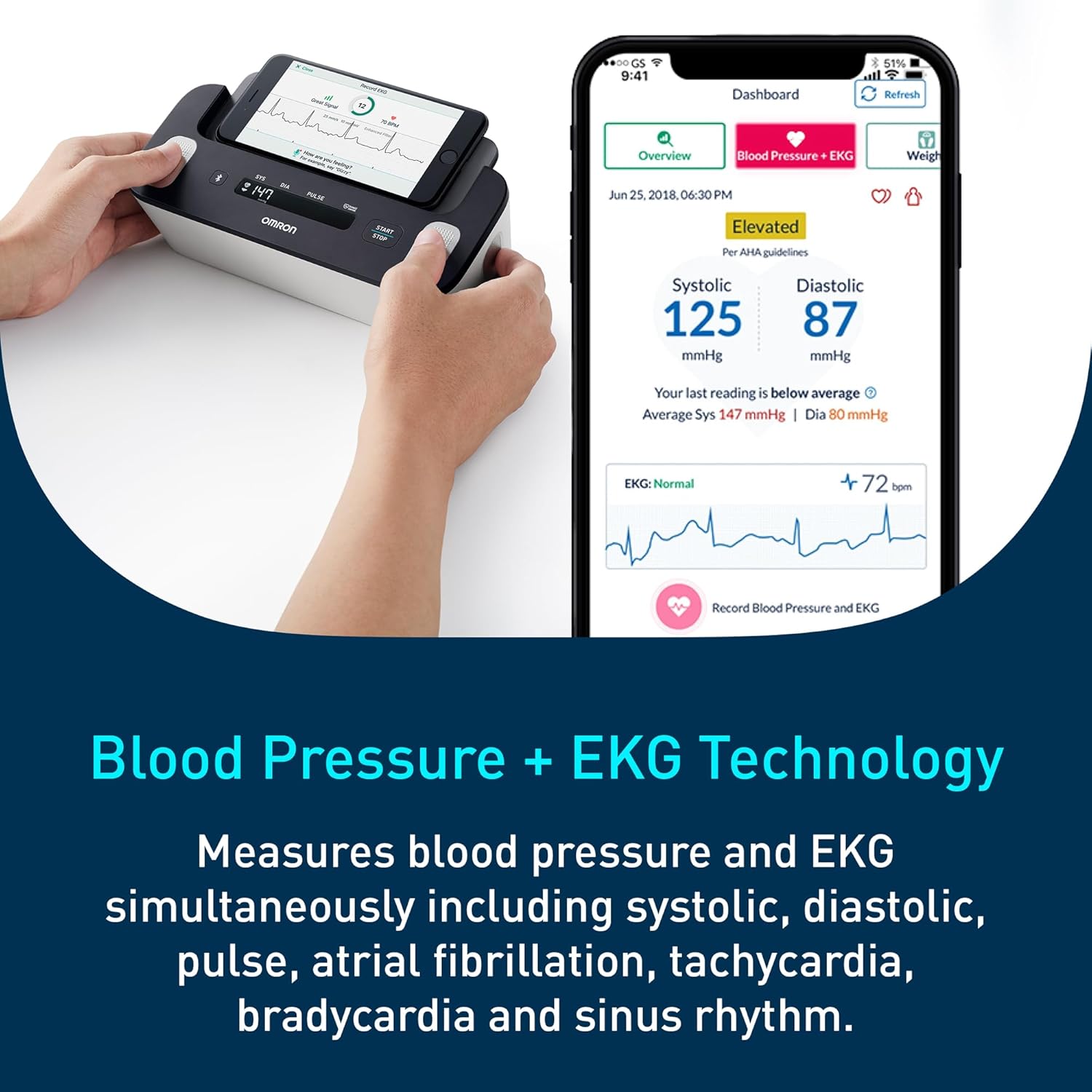 OMRON Complete 2-in-1 Blood Pressure Monitor + EKG for Home Use & Upper Arm Blood Pressure Cuff - #1 Doctor & Pharmacist Recommended Brand - Clinically Validated - Connect App